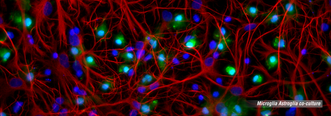 Microglia-Astroglia-co-colture