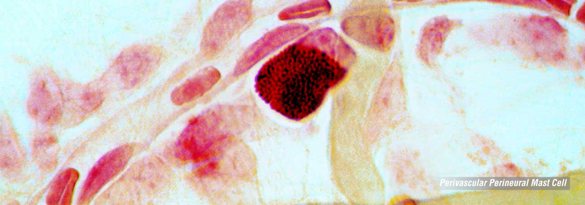 Perivascular-Perineural-Mast-Cell